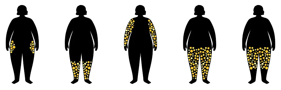cartoon illustration of fat cells in different parts of the body