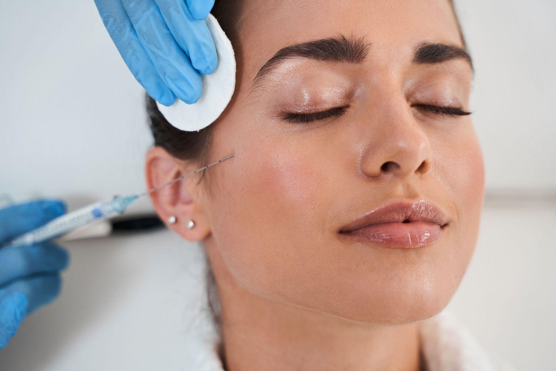 What Are Cheek Fillers?