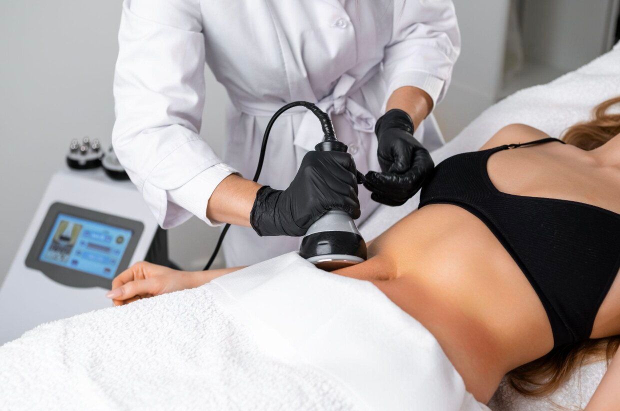 SmartLipo (Minimally Invasive Laser Fat Removal)