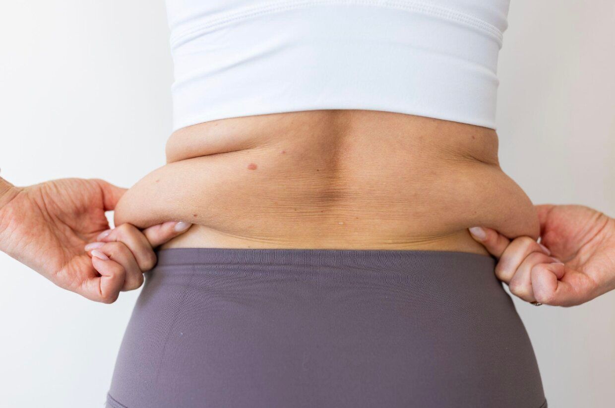 What Is Non-Surgical Fat Reduction?