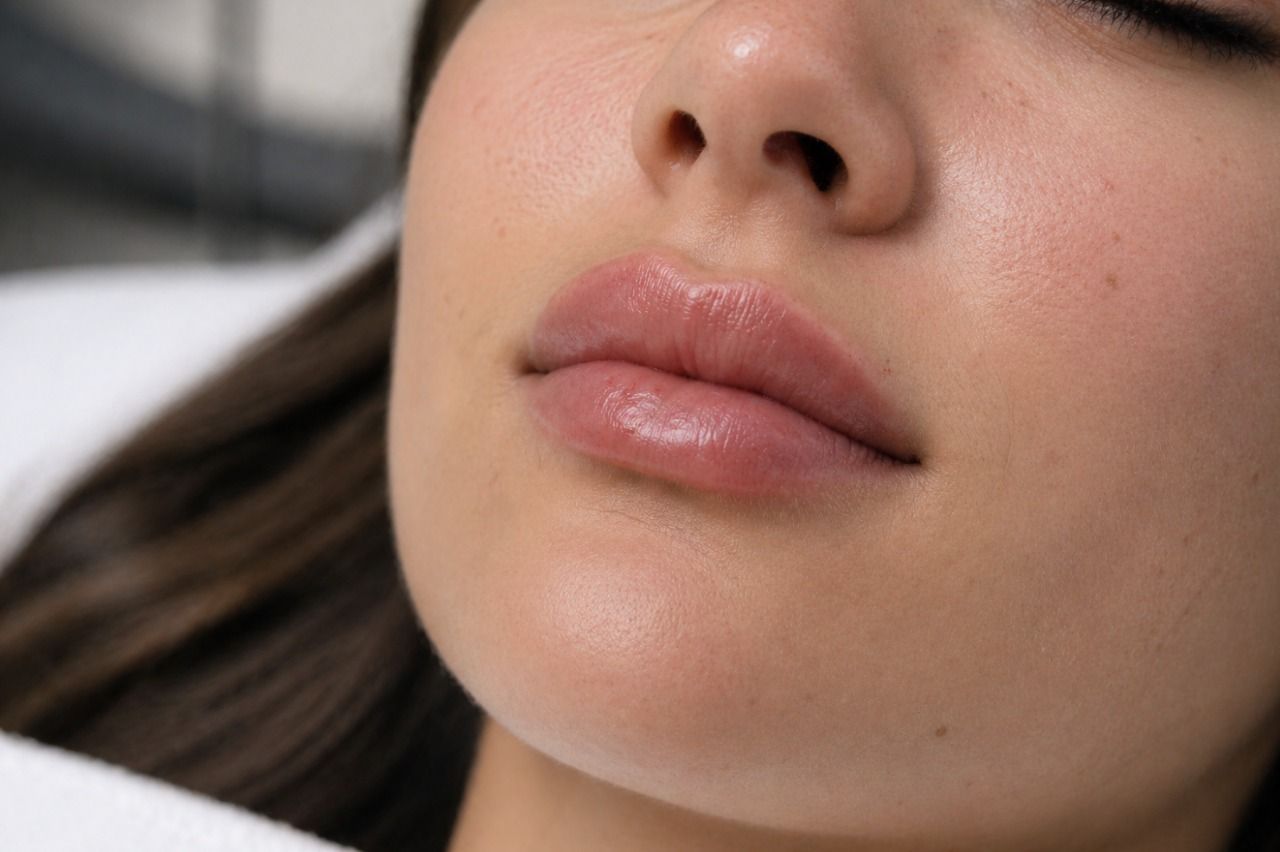 What Lip Fillers Actually Do