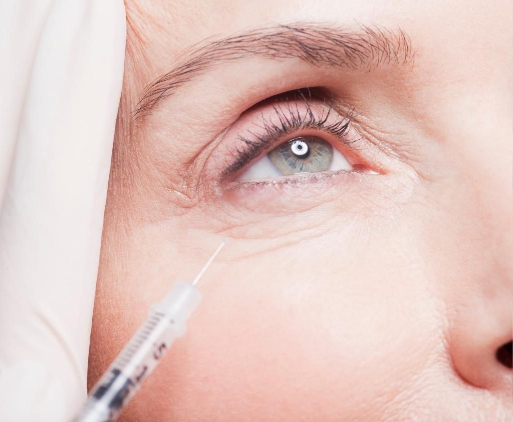 Dermal Eyelets Dermal Fillers for Under Eyes in Carmel, IN: Look Brighter Today