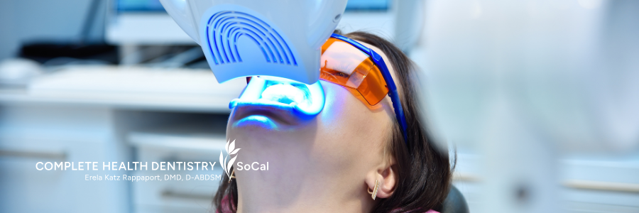 Boost Your Confidence with Professional Teeth Whitening in Poway