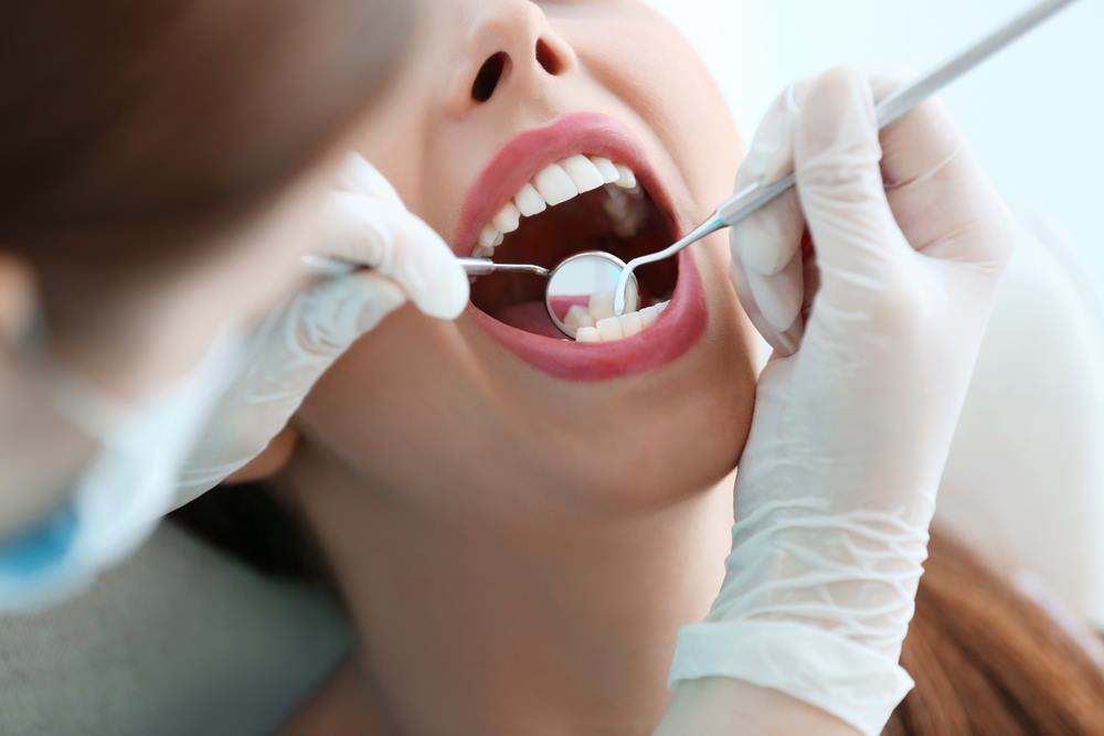 Dentist Examining a Patient's Open Mouth — My Denture Clinic in Benowa, QLD