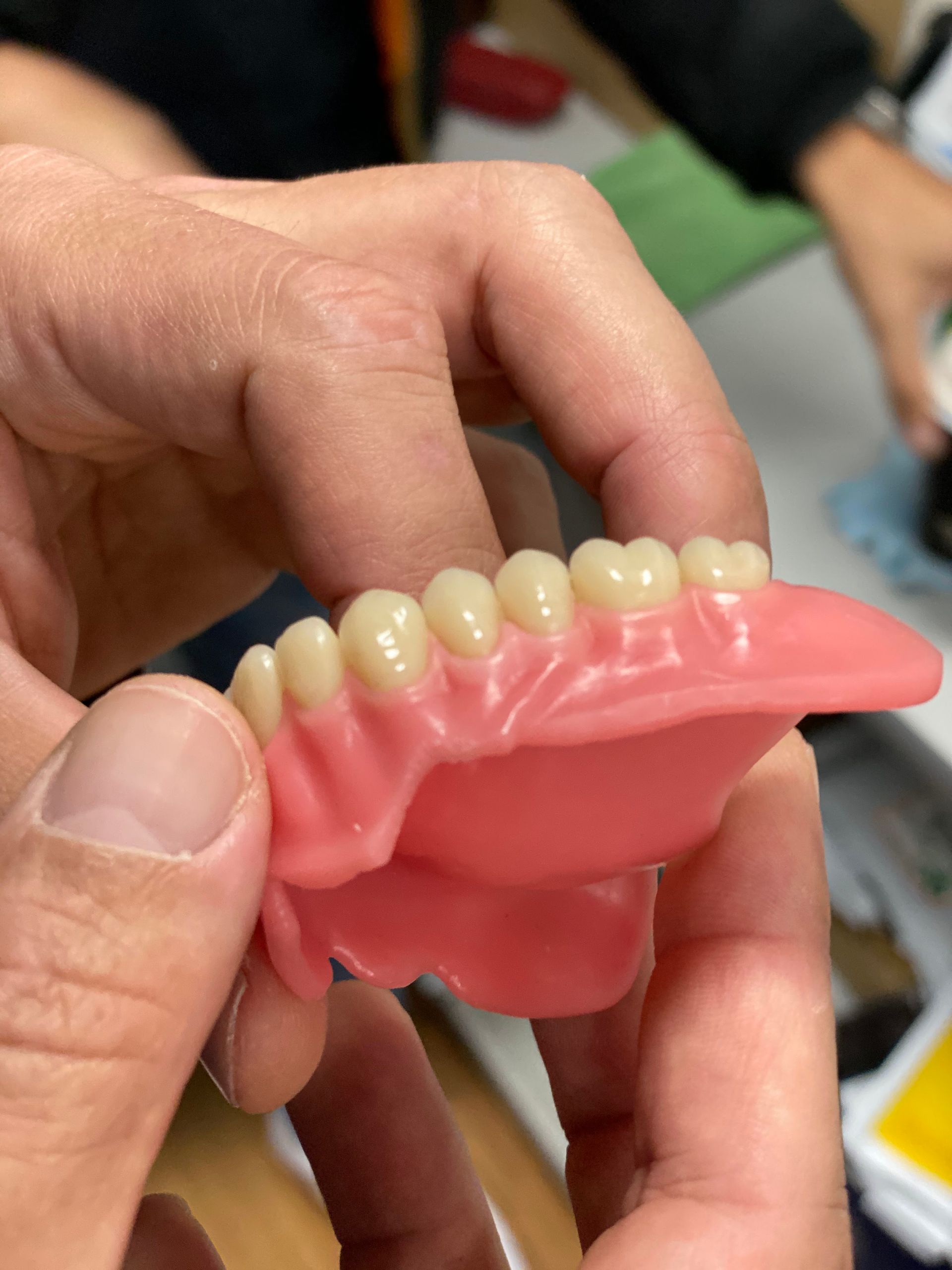 Hand Holding a Set of Upper Dentures — My Denture Clinic in Gold Coast, QLD