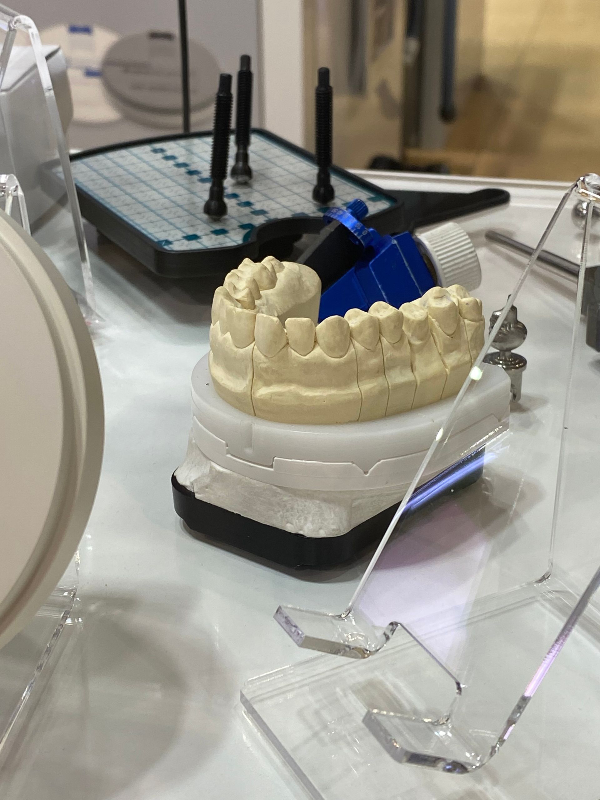 Dental Cast of Teeth on a White Surface, With Tools and Accessories — My Denture Clinic in Tamworth, NSW