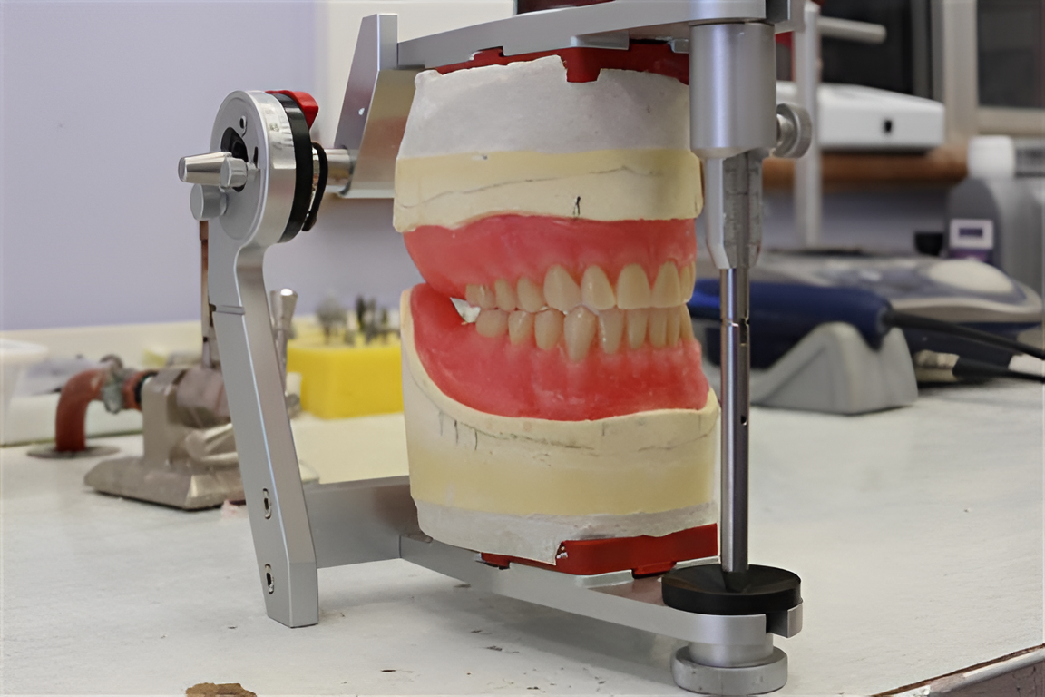 Dental model mounted on an articulator in a denture laboratory.
