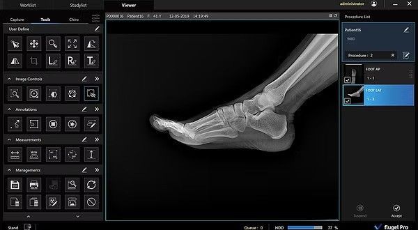 Rayence Xmaru Pro — X-Ray Equipment in Texas Rayence Xmaru Pro— X-Ray Equipment in Texas