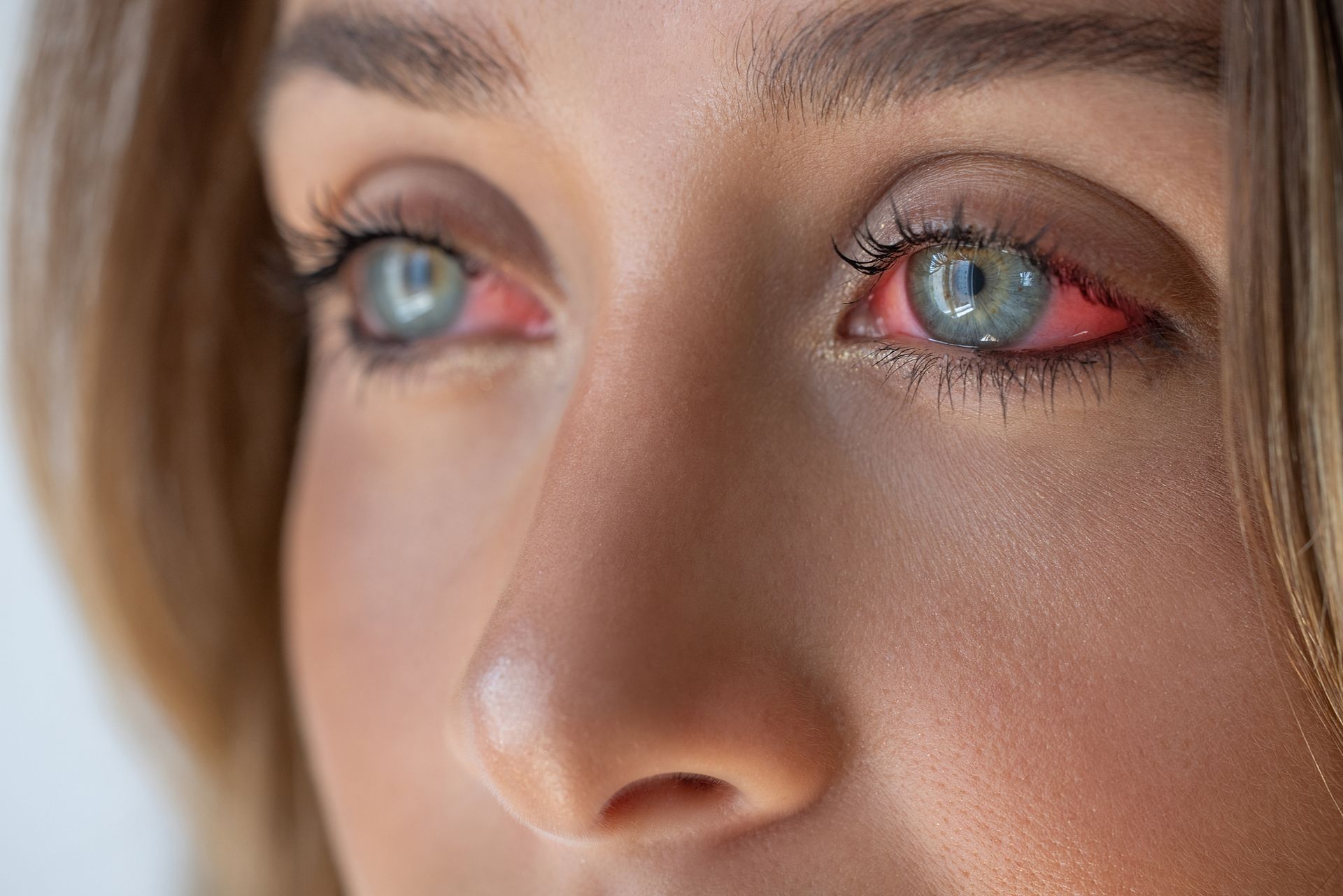 A close up of a woman 's red eyes.