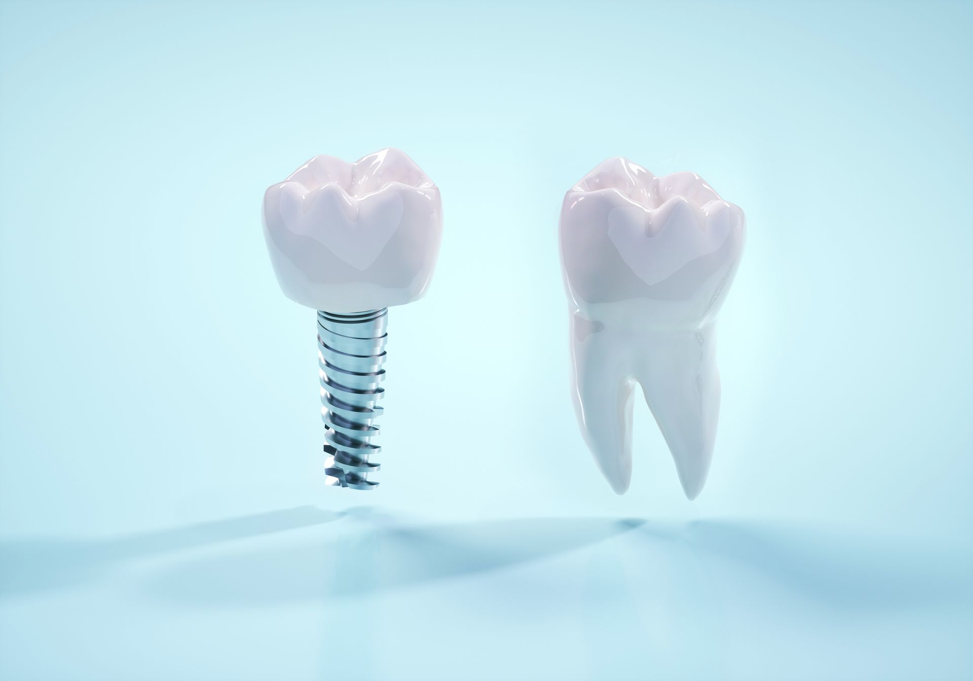 Dental Implants — Auburndale, FL — Dwight H. Pate DMD PA