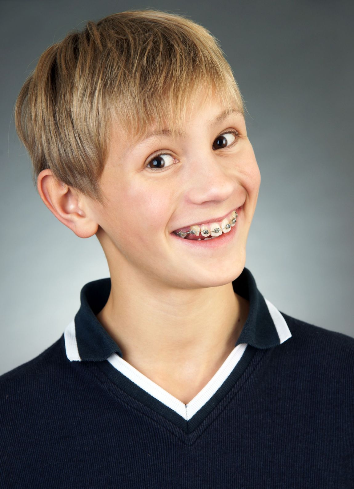 adolescente con apparecchio dentale