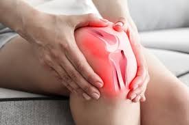 DR. ALFREDO PENAGOS PANIAGUA - BURSITIS
