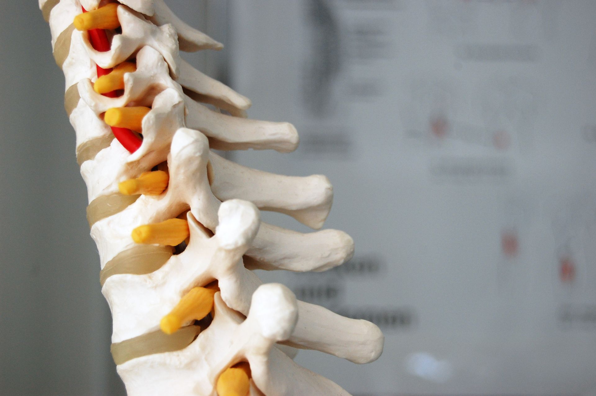 Model of a human spine, side view, showing vertebrae and discs in a neutral setting.