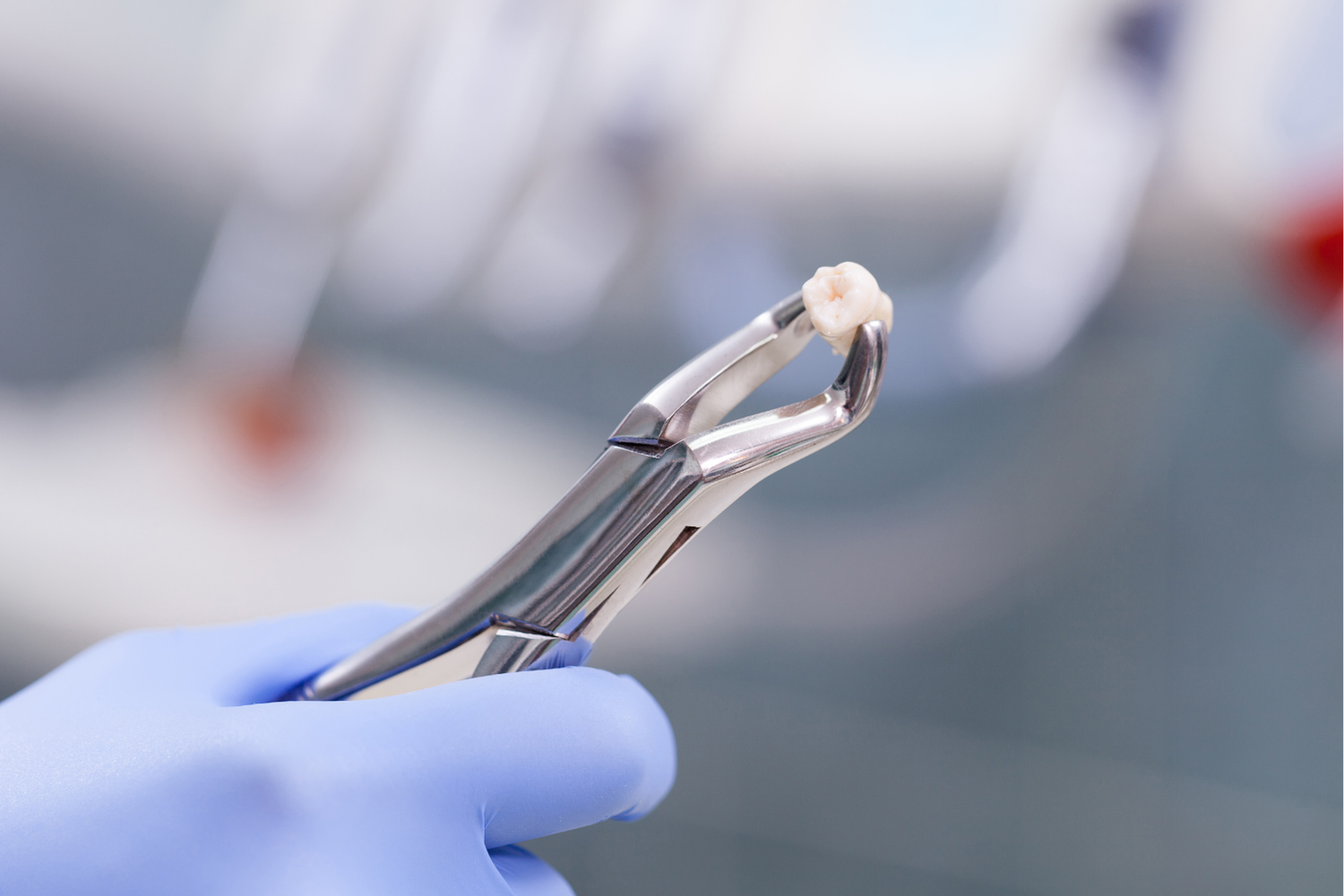 Gloved hand holding a dental extraction forceps against a blurred clinical background