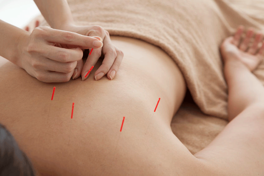 #license #florida #medical #acupuncturist