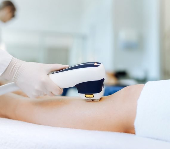 Laser Hair Removal Niagara Falls European Laser Spa