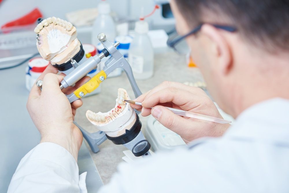 A Dentist is Working on a Model of a Person's Teeth — Tweed Banora Dental In Tweed Heads South, NSW