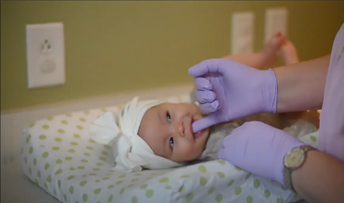 A medical professional in purple gloves examines the mouth of an infant lying on a patterned changing pad.