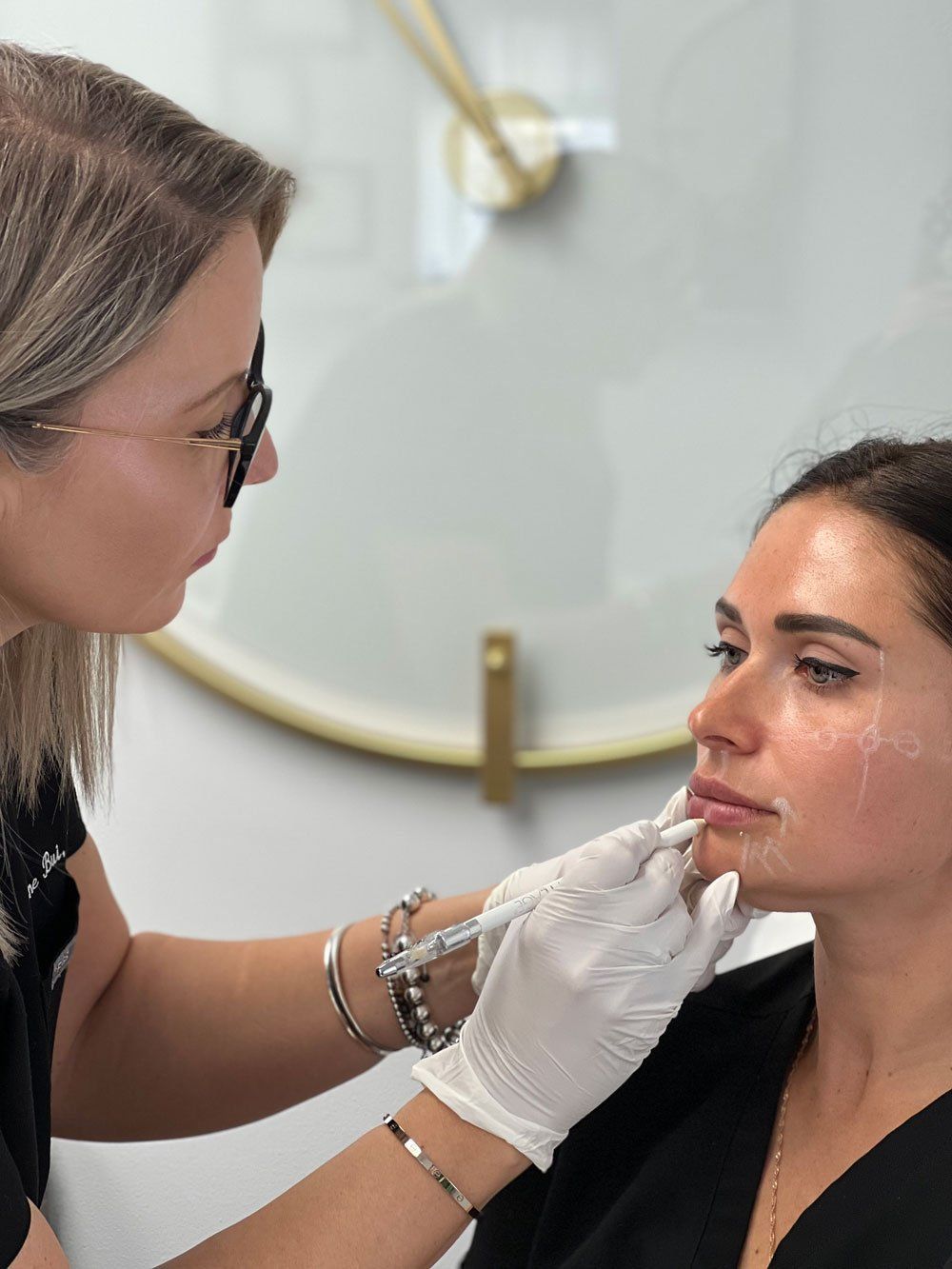 Dermal Fillers