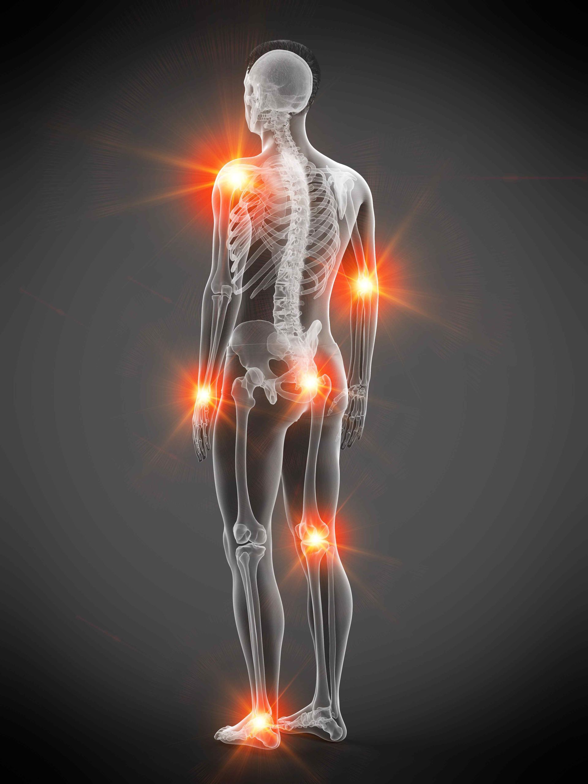 Points of fibromyalgia pain