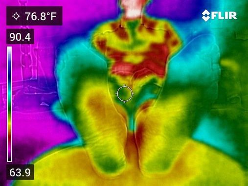 Thermal scans of feet with neuropathy