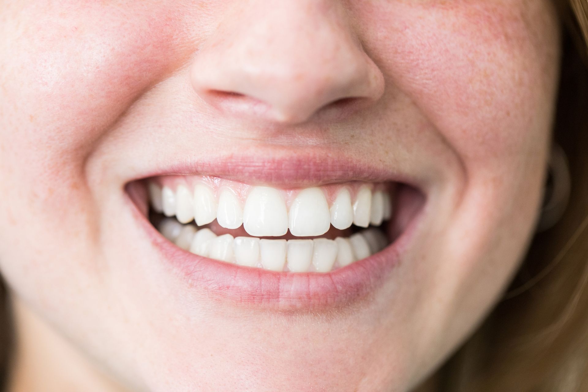 Primo piano di una persona sorridente, che mostra i denti bianchi.