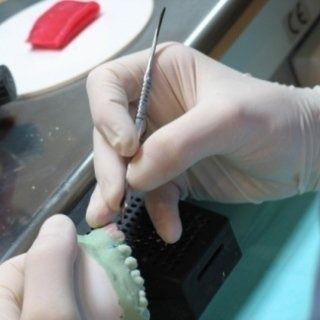 Mani guantate che utilizzano uno strumento odontoiatrico per lavorare su uno stampo dentale verde in un ambiente di laboratorio.