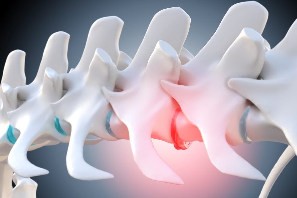 Spinal Column Model — Marlin Coast Veterinary Hospital in Trinity Beach, QLD