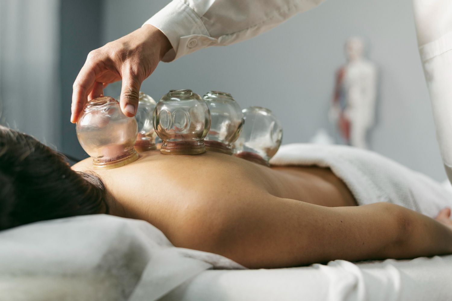 A practitioner applying glass suction cups to a person's back during a cupping therapy session in a clinic.