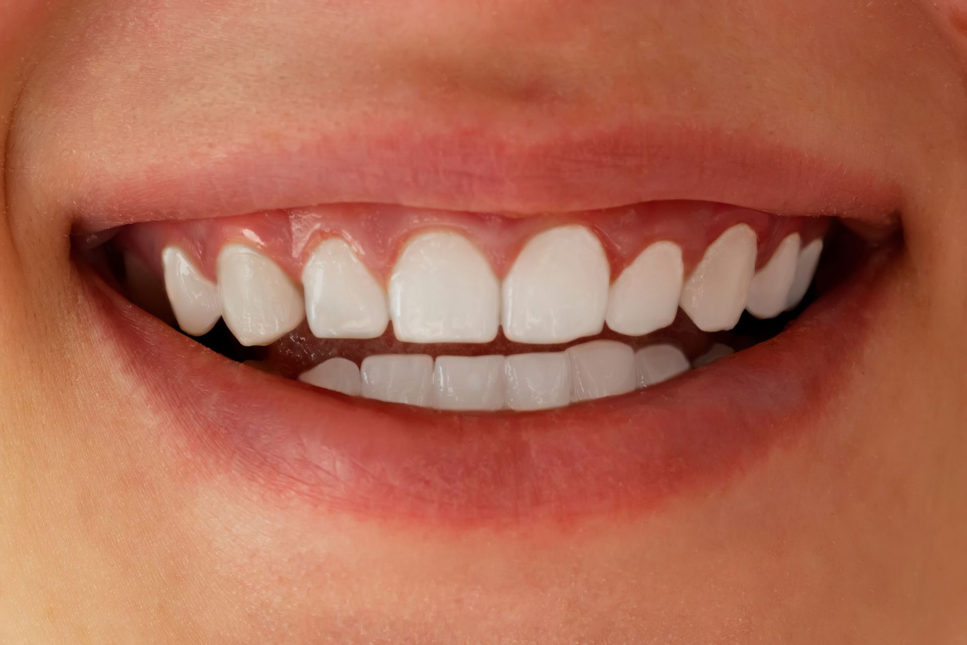 After photo of a woman's smile