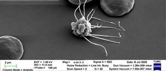 SEM: activated platelet with pseudopodia
