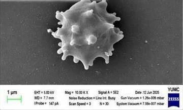 SEM: activated cell close-up
