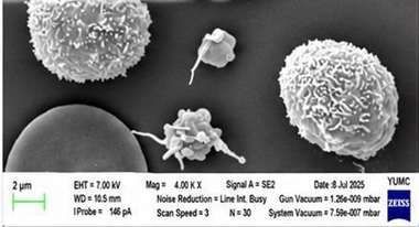 SEM: various activation states
