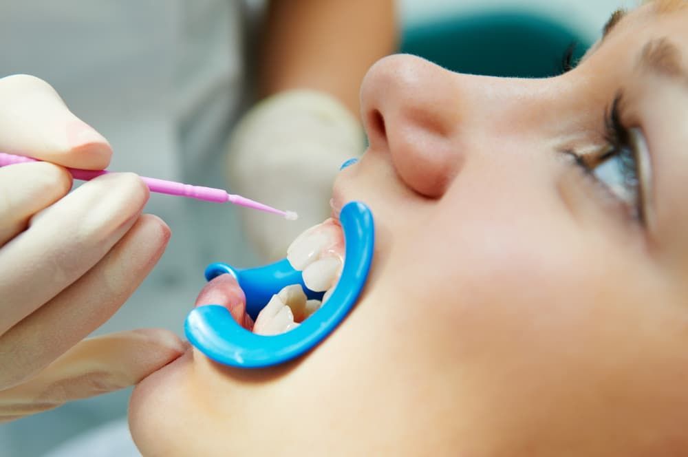 A Woman Is Getting Her Teeth Examined By A Dentist — Regal's Dental In Yeppoon, QLD