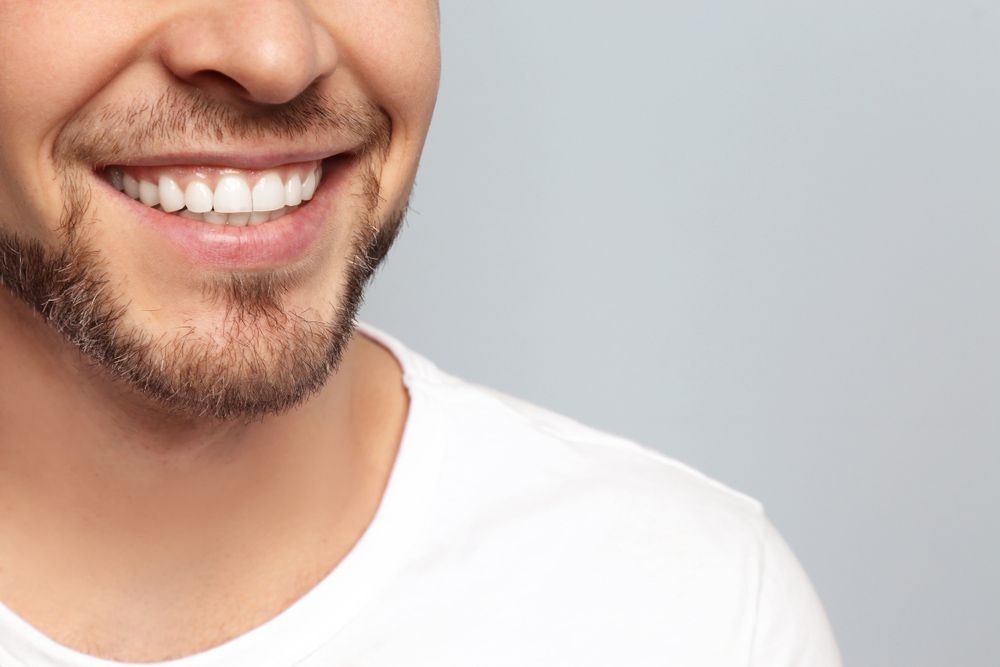 A Man With A Beard And White Teeth Is Smiling — Regal's Dental In Yeppoon, QLD