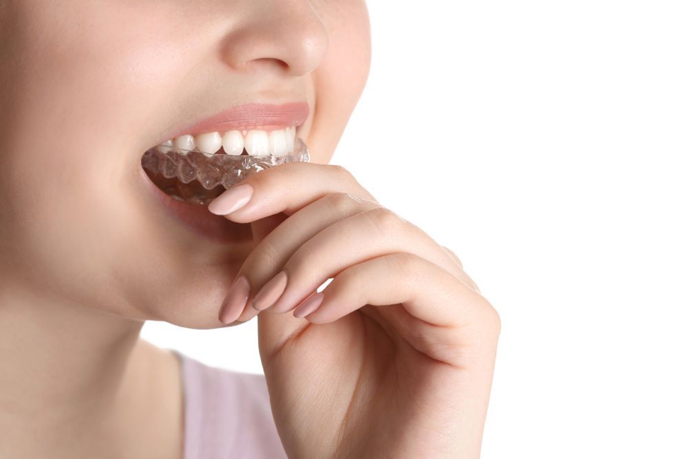 A Woman Is Eating A Piece Of Chocolate With A Clear Brace On Her Teeth — Regal's Dental In Yeppoon, QLD