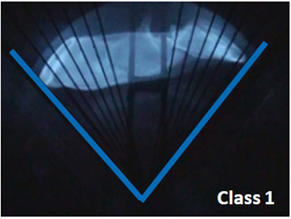 Blue V-shaped lines over a dark window or screen, labeled “Class 1” in the corner.