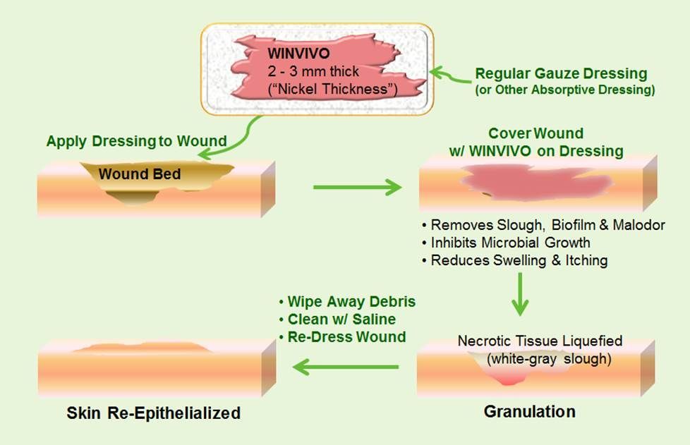 An infographic showing the four-step wound treatment process using WinVivo to clean, granulate, and heal skin.