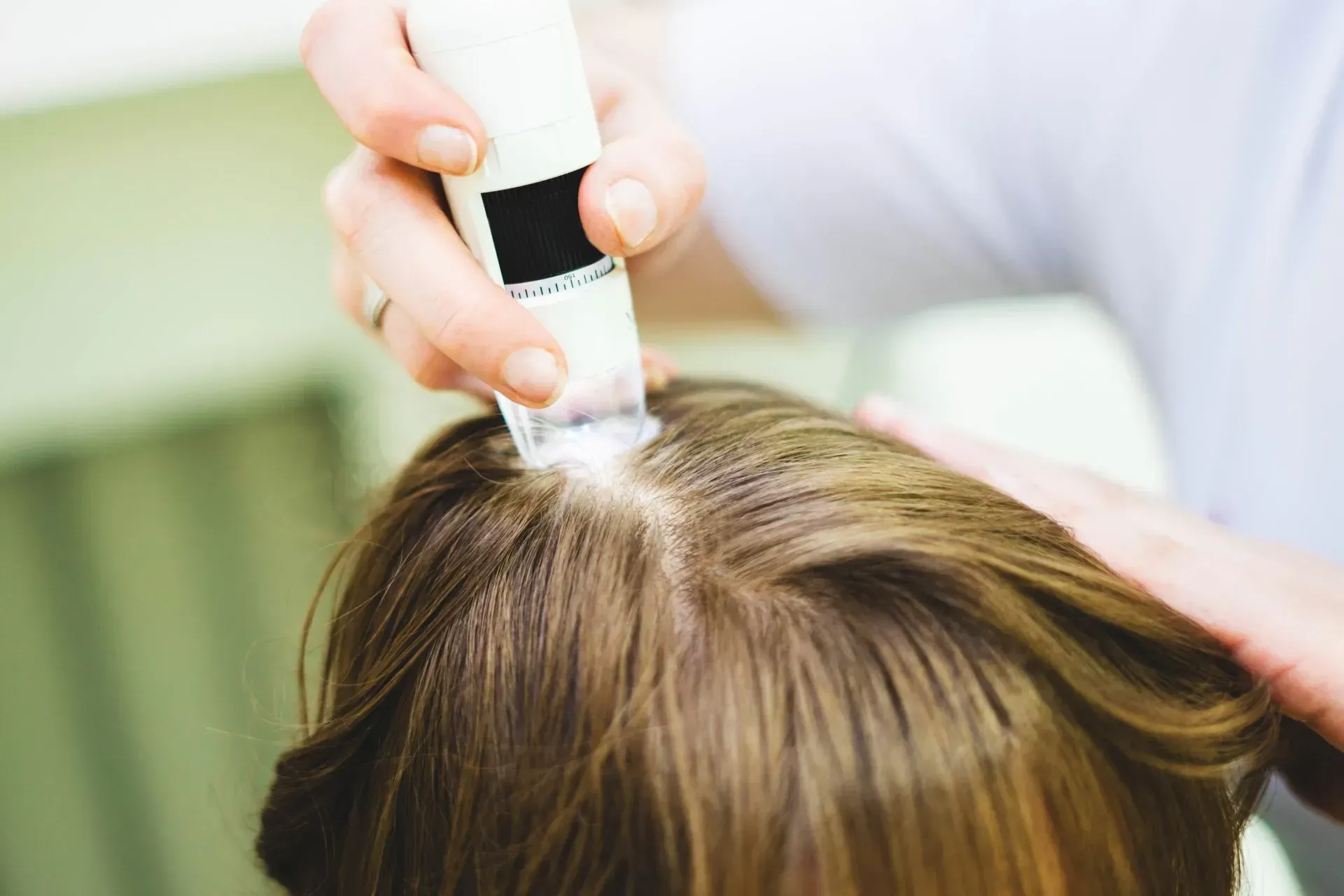 Person's scalp being examined with a handheld device, likely for hair or skin analysis.