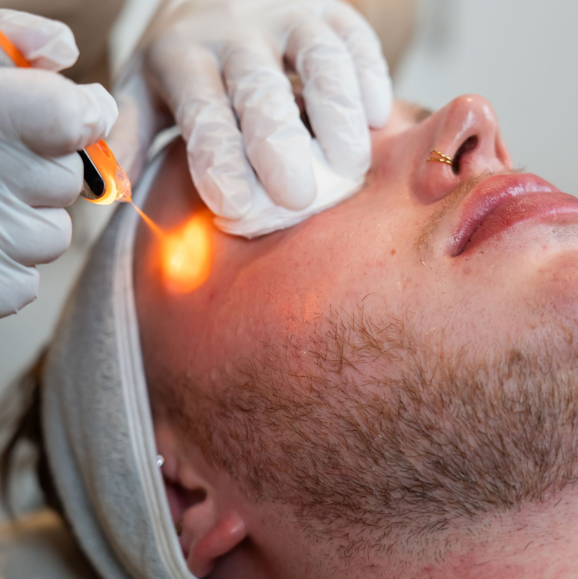 Complete Eye Renewal behandeling Amsterdam