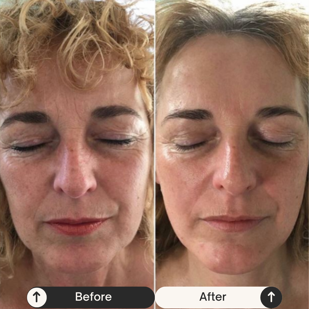 Skin Longevity huidverjonging bij Gustil Aesthetics Amsterdam