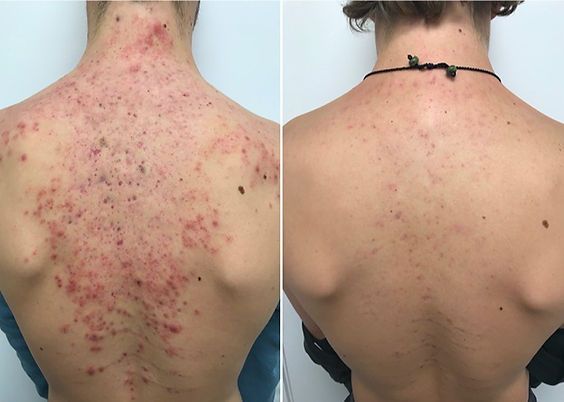 Nourish Body - Before and After 2