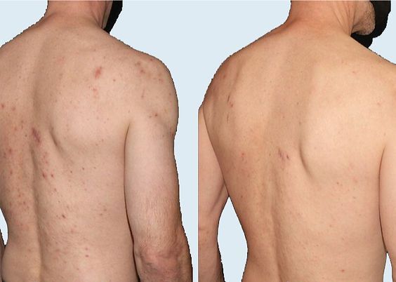 Nourish Body - Before and After 1