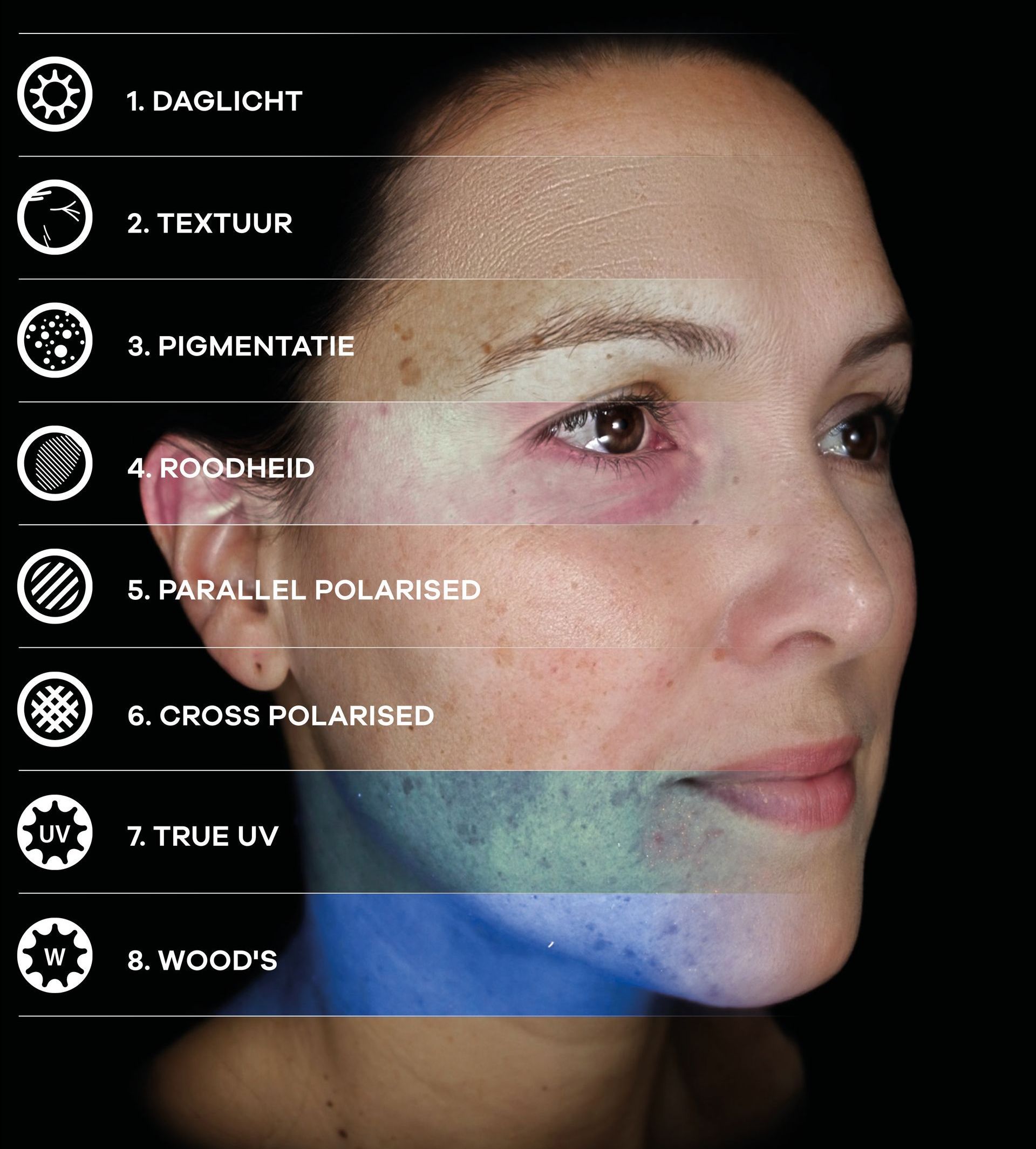 Advanced Skin Analysis with Observ 520X