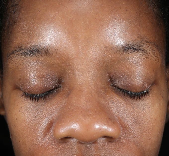 After iS Clinical Active Peel System