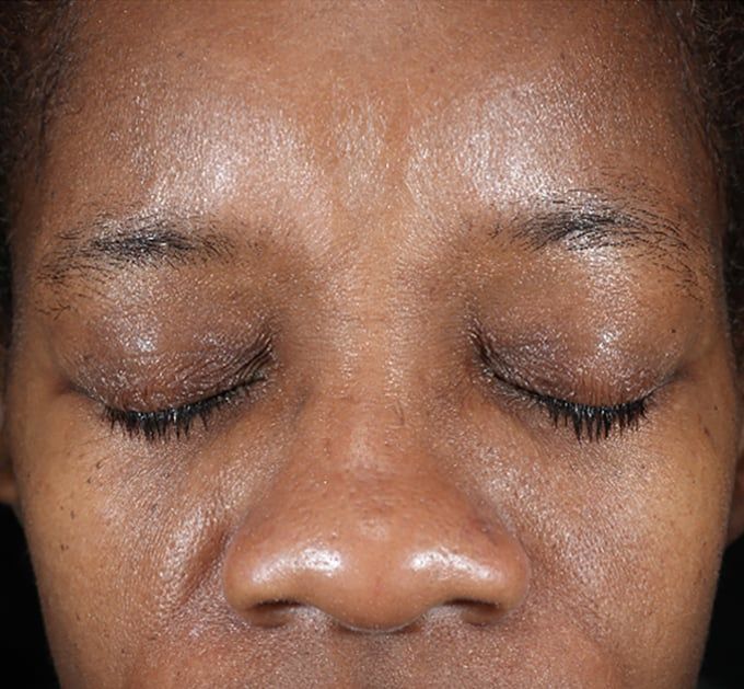 Before iS Clinical Active Peel System