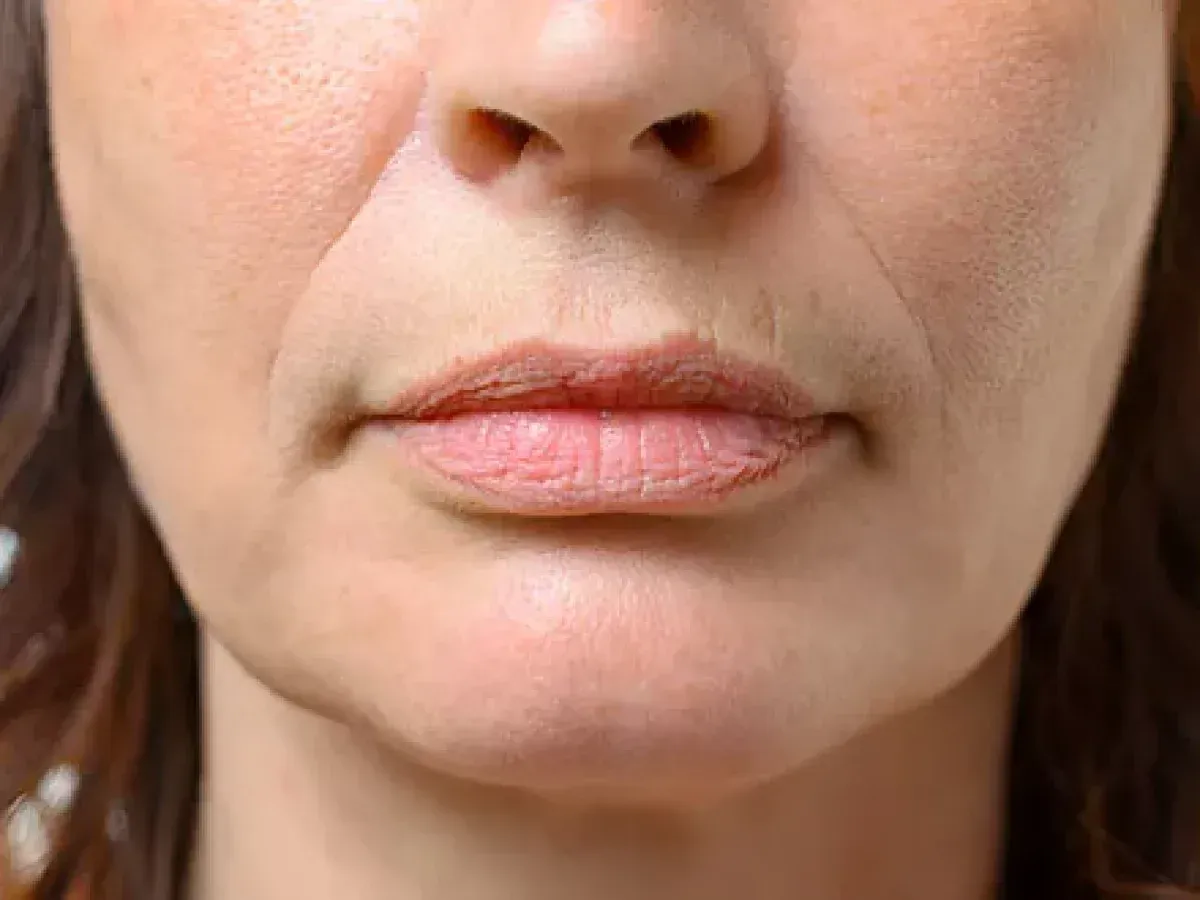 Velvet Skin Facial