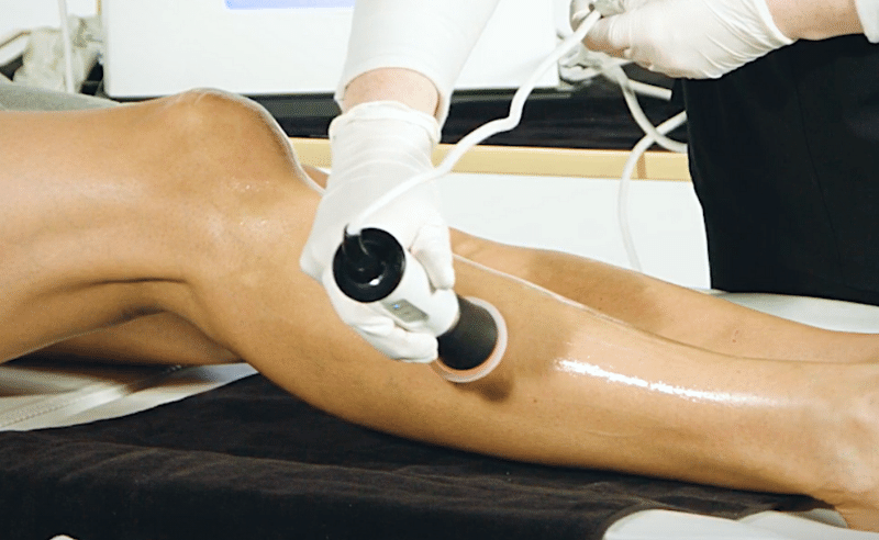 Leg Treatment Tripollar RadioFrequency