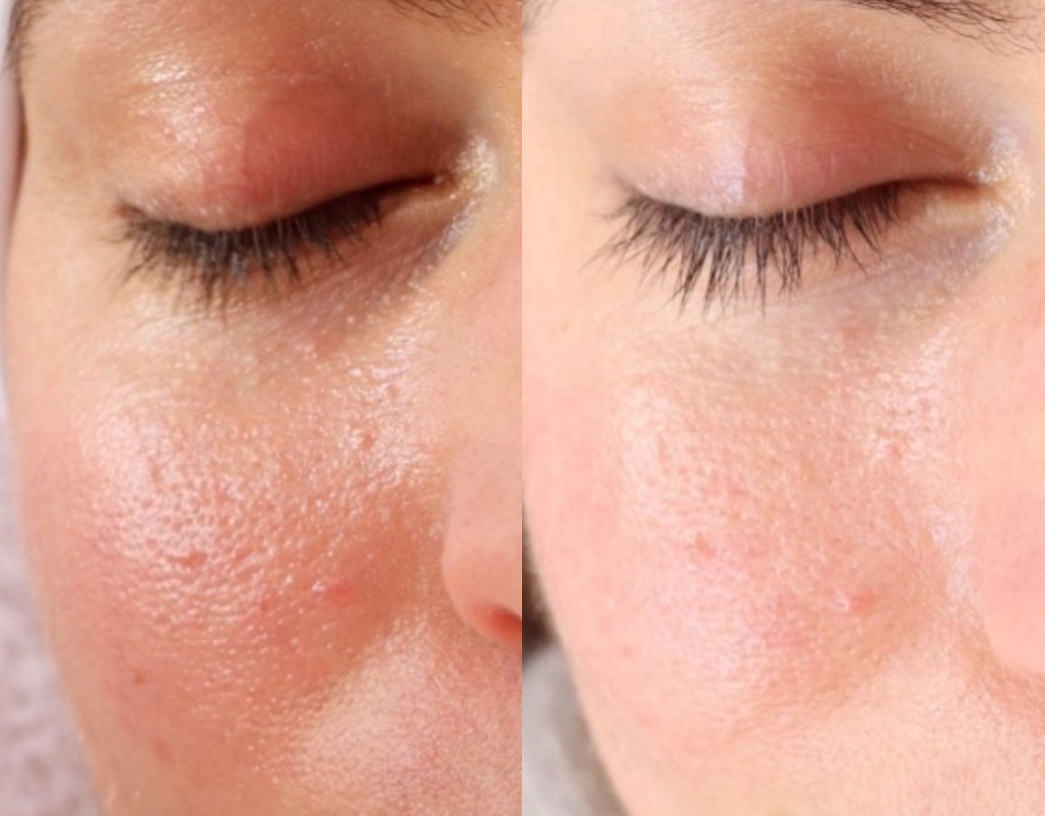Before and after 4