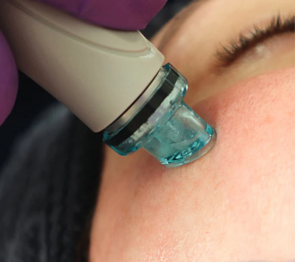 Close-up of HydraFacial Treatment